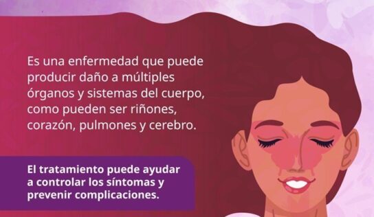 Secretaría de Salud se une a la conmemoración del Día Mundial del Lupus